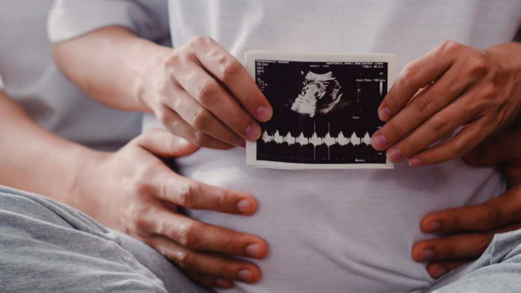 รูปทารกจาก ultrasound