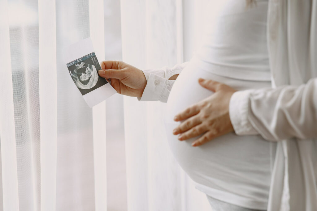 รูปทารกจากผล ultrasound